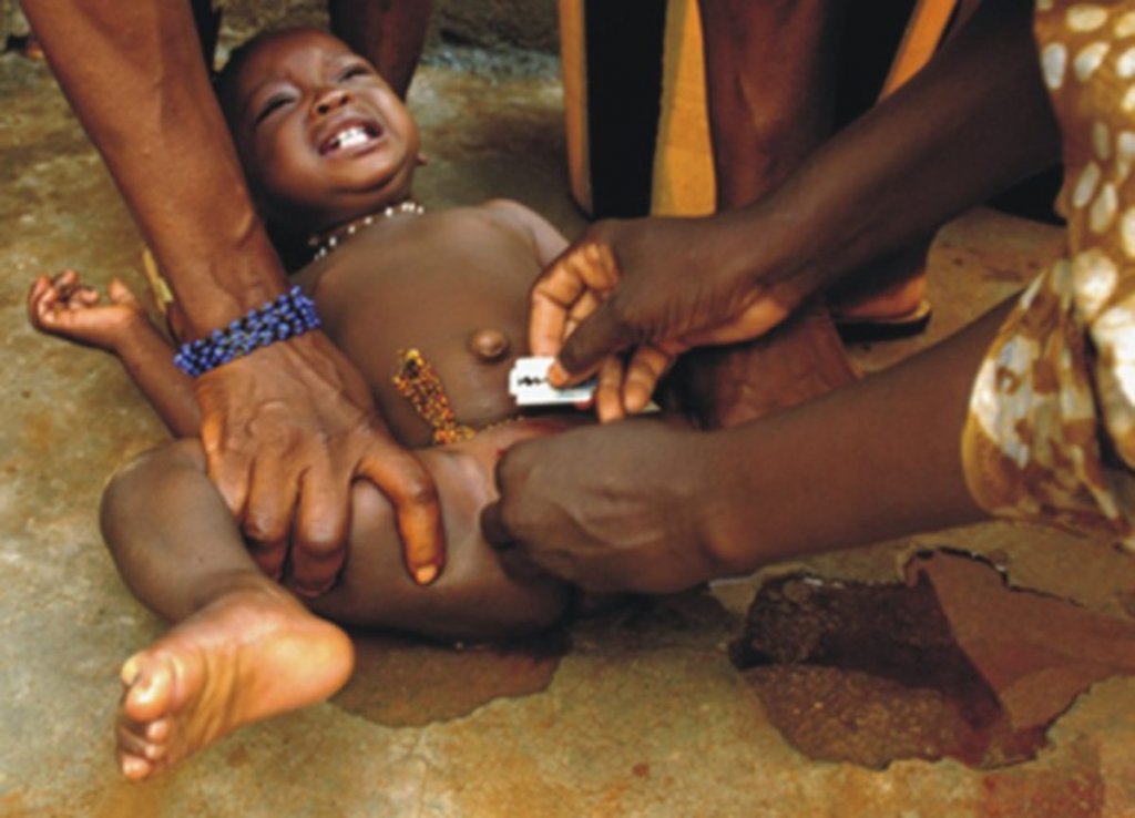 circumcision in igboland 1200x865 1